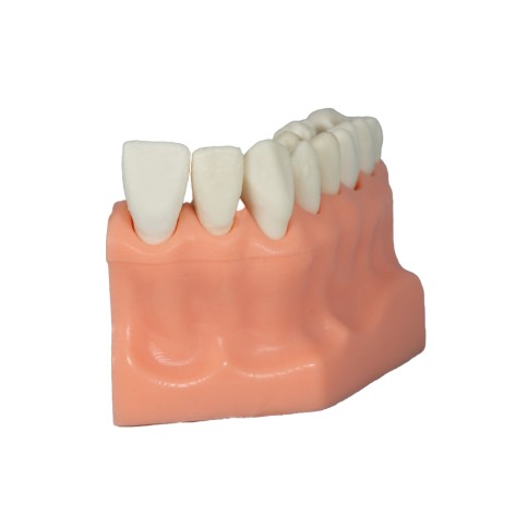 Tipodonto Acrílico de 1/4 Arcada Adysa