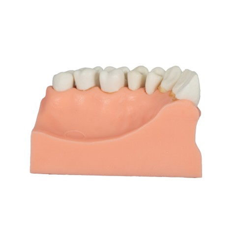 Tipodonto Acrílico de 1/4 Arcada Adysa