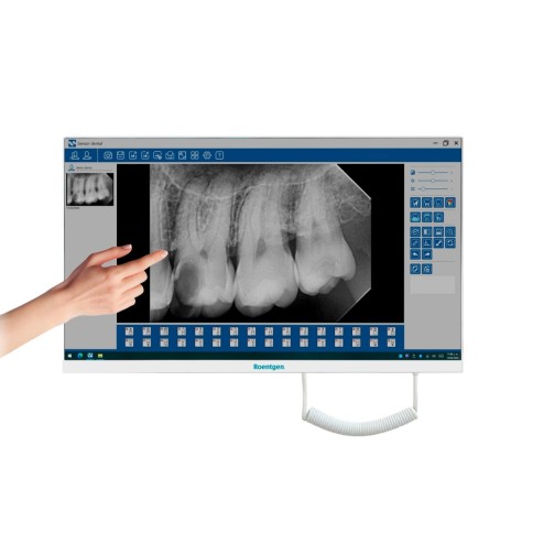 Monitor PC All in One Touch 24" con Cámara Intraoral RTG-PC300