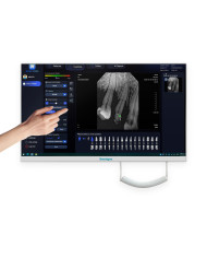 Monitor PC All in One Touch 24 con cámara intraoral RTG-PC300