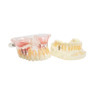 Tipodonto Con Implantes y Senos Paranasales