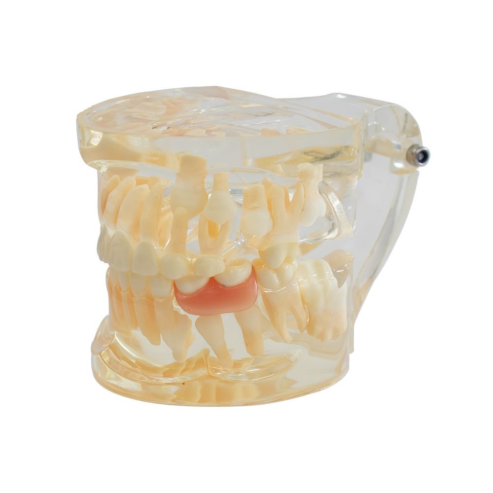 Tipodonto Dentición Infantil 6 años