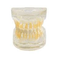 Tipodonto Dentición Infantil 3 años