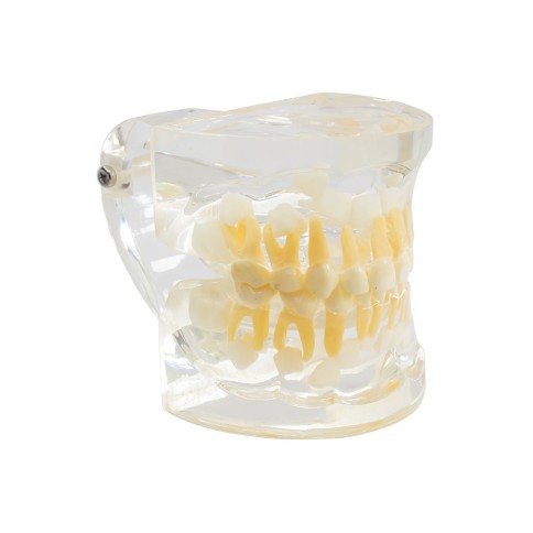 Tipodonto Dentición Infantil 3 años