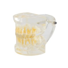 Tipodonto Dentición Infantil 3 años