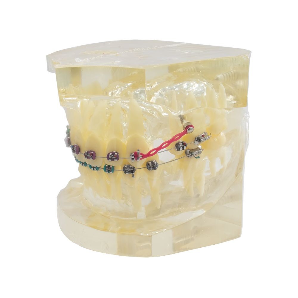 Tipodonto Con Brackets