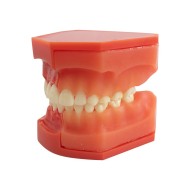Tipodonto Dentición Mixta