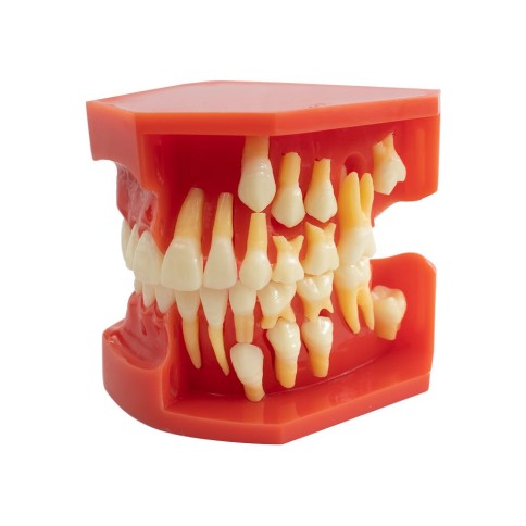 Tipodonto Dentición Mixta