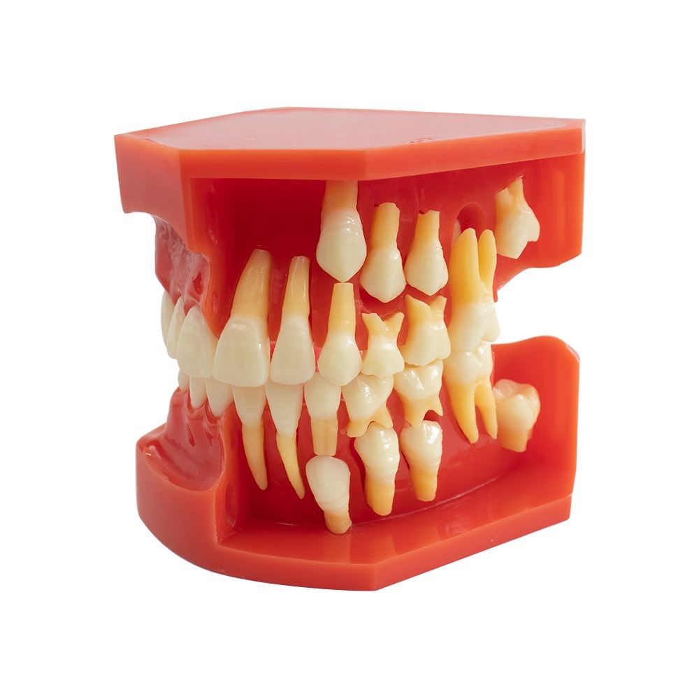 Tipodonto Dentición Mixta