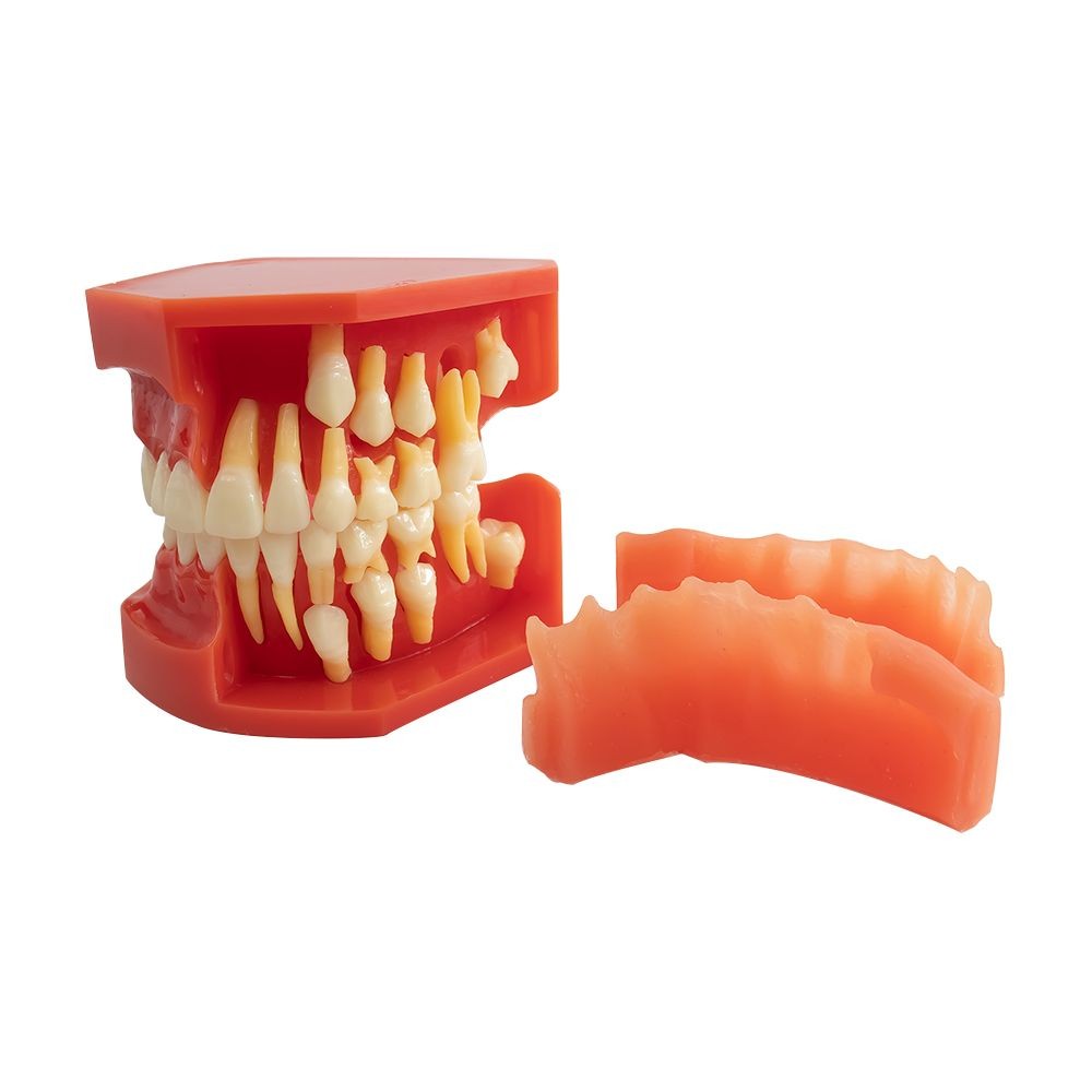 Tipodonto Dentición Mixta