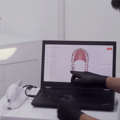 Escáner Intraoral 3D Heron IOS