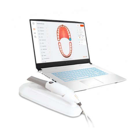 Escáner Intraoral 3D Heron IOS