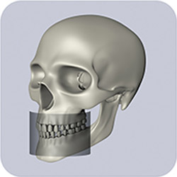 6x8 - UPPER/LOWER JAW