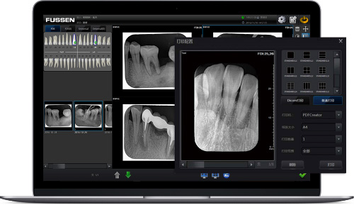 Láser Radiografias