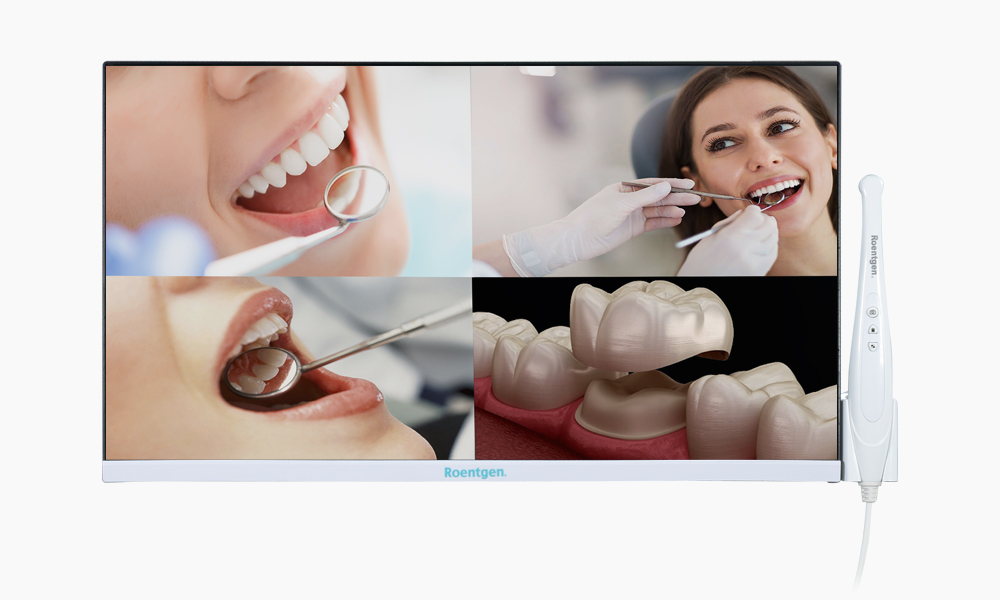 Monitor con Cámara Intraoral RTG-ST22 - vista 1