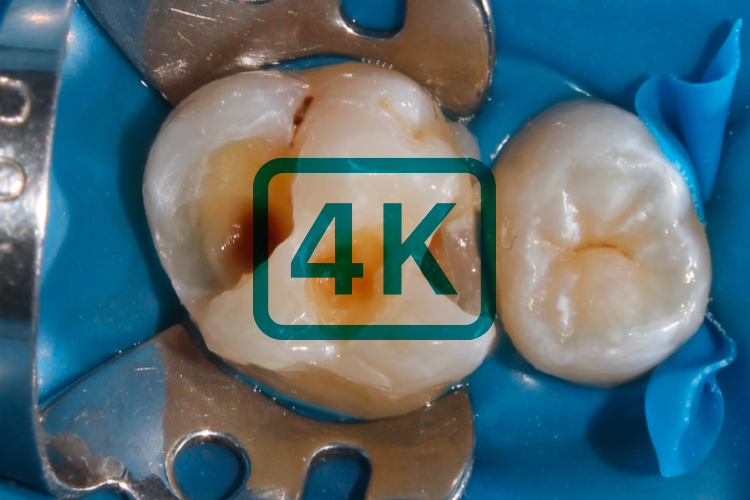 Visualización clínica en 4K Ultra HD