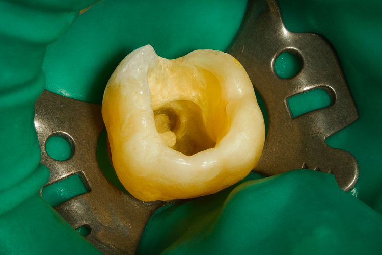 34X de aumento en procedimientos odontológicos