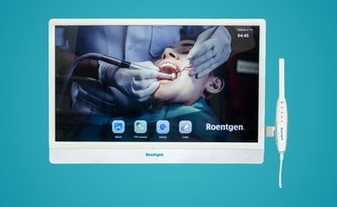 Cámara Intraoral: Beneficios Reales para tu Consultorio Dental